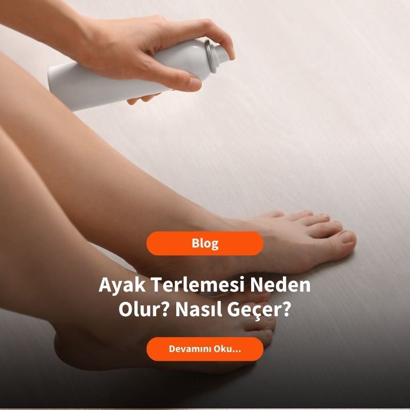 Ayak Terlemesi Neden Olur? Nasıl Geçer?